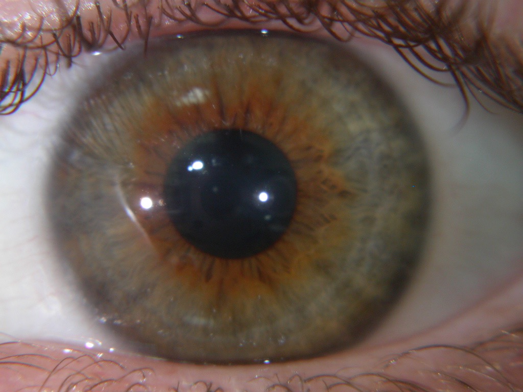 Eye of a mediator